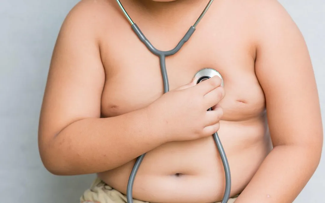 obesidad infantil